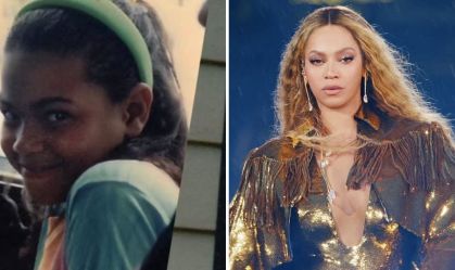 Beyoncé recorda jornada vivendo com psoríase desde a infância; assista