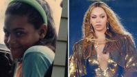 Beyoncé recorda jornada vivendo com psoríase desde a infância; assista