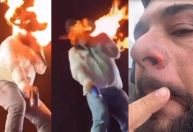 Cantor sertanejo Léo mostra queimaduras após acidente em show