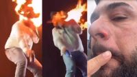 Cantor Léo aplica babosa direto em queimaduras; é seguro? Entenda