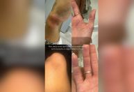 Ex-namorada acusa MC Brisola de agressão e mostra lesões na internet