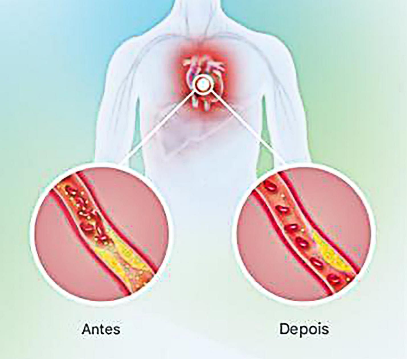 "antes"-e-"depois"-da-a´çicação-d-´verve-102