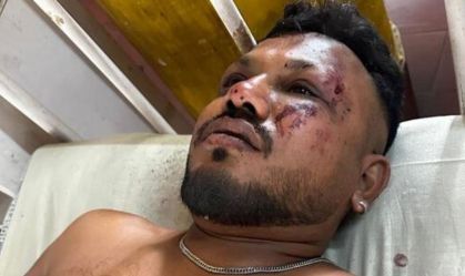 Sobrevivente de acidente na Índia pode ter amnésia pós-traumática