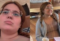 Viih Tube volta à rotina após combo de cirurgias plásticas: "Aos poucos"