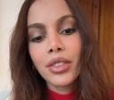 Anitta se pronuncia pela primeira vez após "novo rosto"; assista