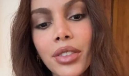 Anitta se pronuncia pela primeira vez após "novo rosto"; assista