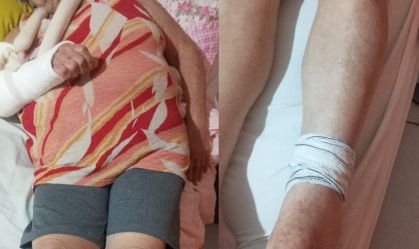 Idosa de 77 anos é agredida com cabo de vassoura em condomínio no RJ