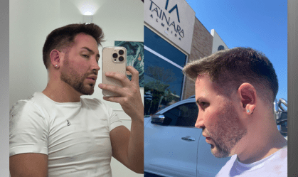 Empresário é agredido por causa de vaga de estacionamento em SP