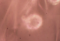 Pela 1ª vez no Brasil, cientistas acham microplástico em cordão umbilical