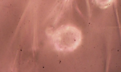 Pela 1ª vez no Brasil, cientistas acham microplástico em cordão umbilical