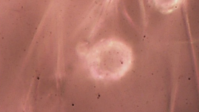 Pela 1ª vez no Brasil, cientistas acham microplástico em cordão umbilical