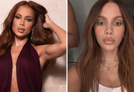 Anitta confirma procedimento estético, mas não detalha qual