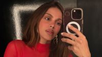 Anitta fala sobre repercussão de suas plásticas: "Polêmica"