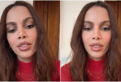 Anitta se pronuncia pela primeira vez após "novo rosto"; assista