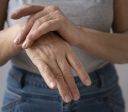 Estudo global vê aumento alarmante de artrose em mulheres na pós-menopausa