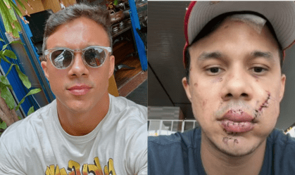 Polícia identifica agressor de personal espancado em bar de SP