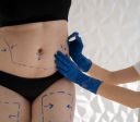 Brasil é o país que mais realiza cirurgia plástica no mundo, diz relatório