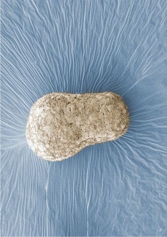 Uma imagem de um modelo de embrião humano desenvolvido pela pesquisadora Naomi Moris no Instituto Francis Crick em Londres, que foi tirada com uma técnica chamada microscopia eletrônica de varredura, que mostra o aglomerado de células em três dimensões • Naomi Moris via CNN Newsource
