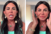 Gretchen mostra resultado de nova harmonização: "Não existe desarmonização"
