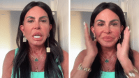 Gretchen mostra resultado de nova harmonização: "Não existe desarmonização"