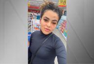 Mosca de banheiro entra no olho de influenciadora e causa infecção