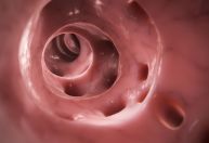 Diverticulite em jovens vem crescendo: entenda como prevenir