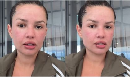 Juliette mostra rosto após procedimento com esperma de salmão; veja
