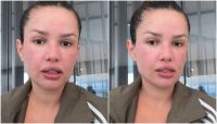 Juliette mostra rosto após procedimento com esperma de salmão; veja