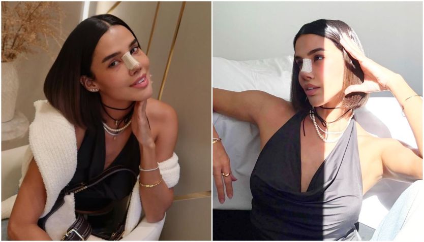 Kerline mostra antes e depois de rinoplastia • Instagram / Kerline