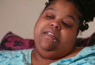 "Quilos Mortais": veja como está Mercedes, que deixou o reality com 313 kg