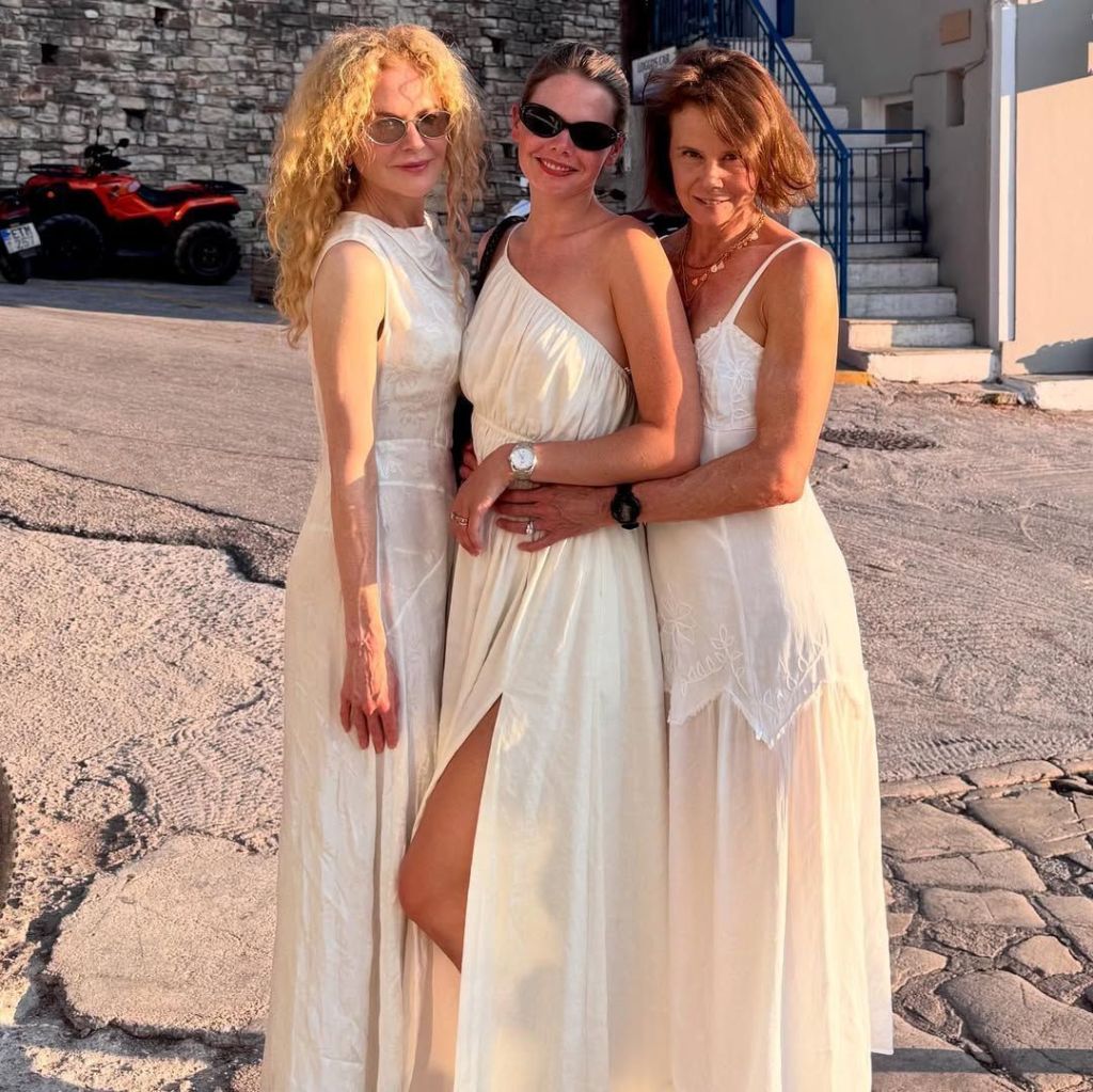 Sobrinha de Nicole Kidman mostra atriz com o cabelo natural