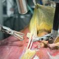 Pela 1ª vez na história, robô faz cirurgia guiado por IA sem ajuda humana