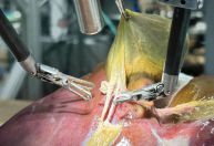 Pela 1ª vez na história, robô faz cirurgia guiado por IA sem ajuda humana