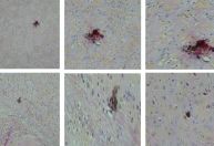 Vacina contra vírus zika mostra resultados promissores em testes