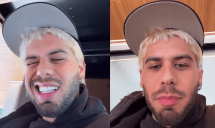 Zé Felipe sofre acidente ao fazer brincadeira com funcionários