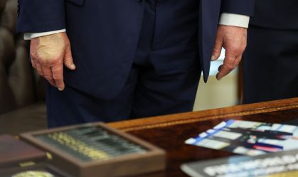 Trump reaparece com mão maquiada após diagnóstico de insuficiência venosa