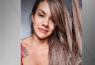 Mulher espancada com 60 socos pelo namorado recebe alta após cirurgia