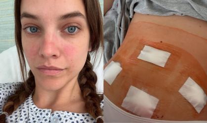 Modelo expõe batalha contra doença e faz alerta: "Te encorajo a investigar"