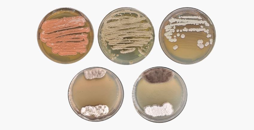 Microbioma amazônico é uma fonte ainda pouco explorada de inovação para a agricultura sustentável • Juan Lopes Teixeira/Esalq-USP
