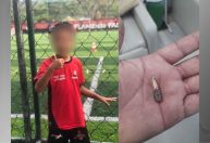 “Papai, não sou bandido”, diz criança baleada em escola do Rio