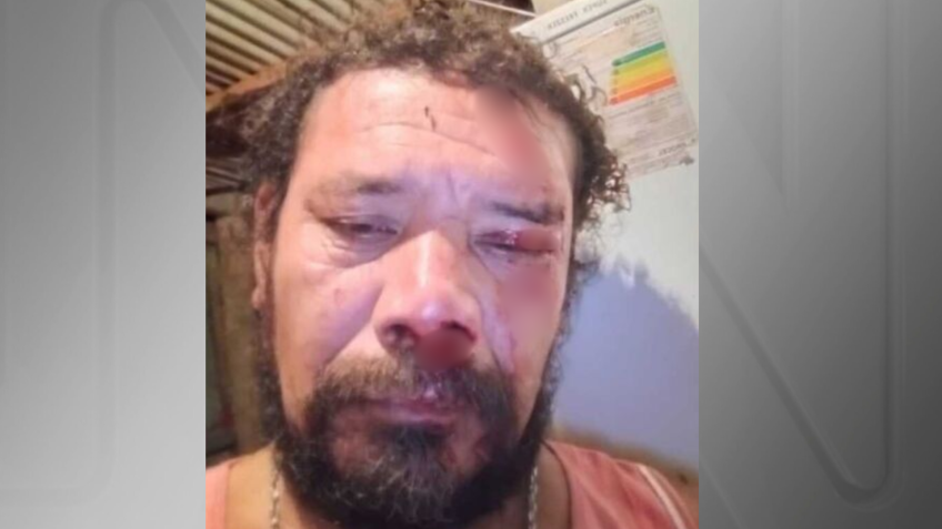 Imagem mostra ferimentos no rosto de homem que afirmou ter sido atacado por onça • Reprodução
