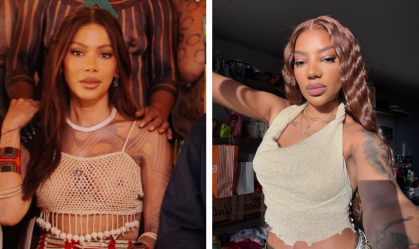 Web compara Anitta a Ludmilla após procedimentos; veja