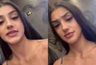 Bia Miranda mostra ferimento após acidente com Gato Preto; veja