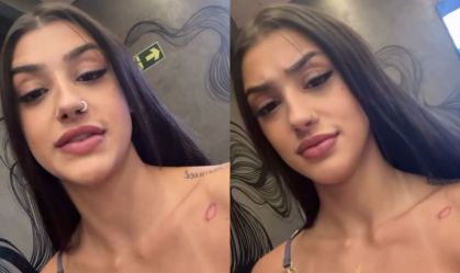 Bia Miranda mostra ferimento após acidente com Gato Preto; veja