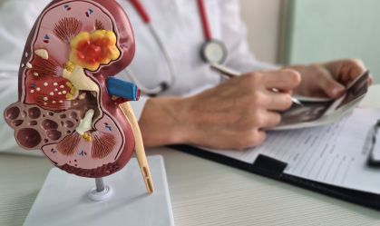 Câncer renal deve crescer quase 80% no Brasil e na América Latina até 2050