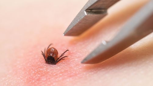 Carrapato de ervo é o vetor da doença de Lyme