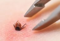Clima mais quente e úmido tem feito subir os casos de doença de Lyme