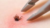 Clima mais quente e úmido tem feito subir os casos de doença de Lyme