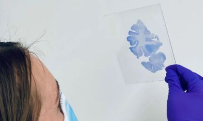 Cérebro de um "superidoso" de 80 anos funciona como o de uma pessoa de 50