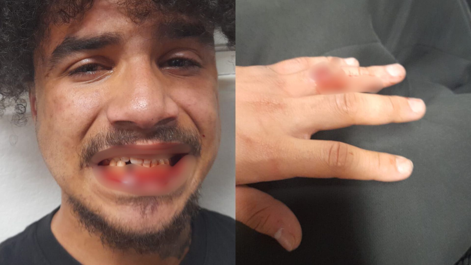 JOVEM AGREDIDO CPTM